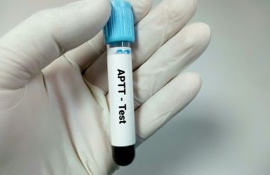 APTT Test Can Check Your Clotting Time