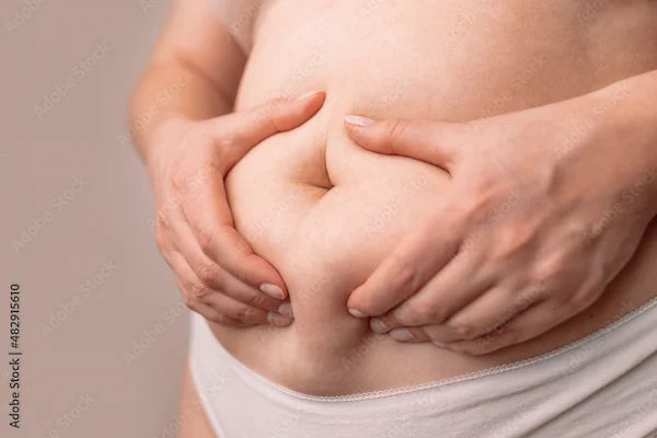 How to Reduce Postpartum Belly?