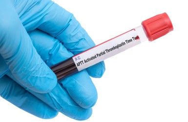 Activated Partial Thromboplastin Time (APTT) Test