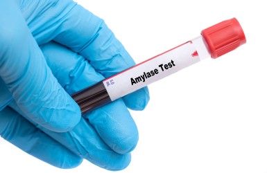 Amylase Test
