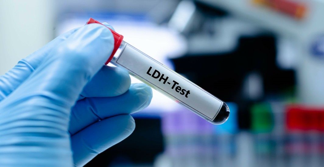 LDH Test