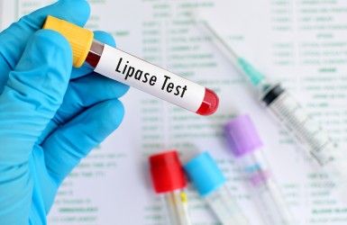 Lipase Blood Test
