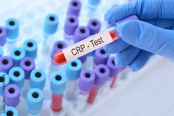 How to Reduce CRP Levels By Food?