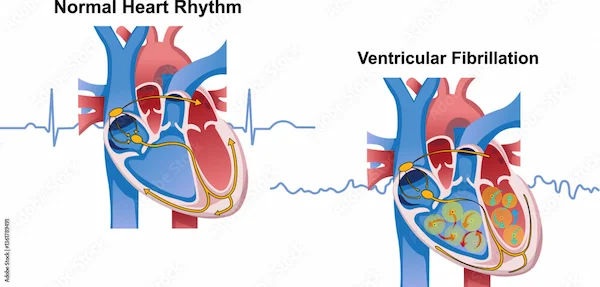 Heart Rate: What’s Normal? Understanding Healthy Ranges and Factors