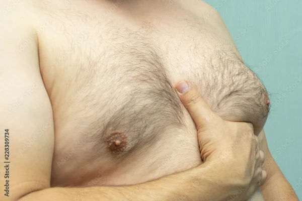 How to Reduce Man Boobs: A Comprehensive Guide