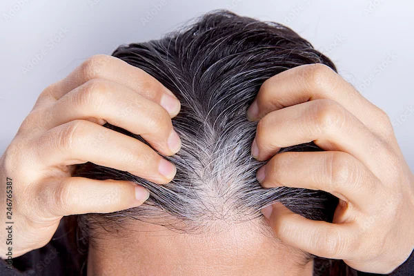 How To Reduce White Hair?