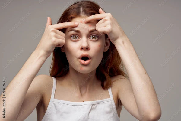 How To Reduce Forehead Acne?