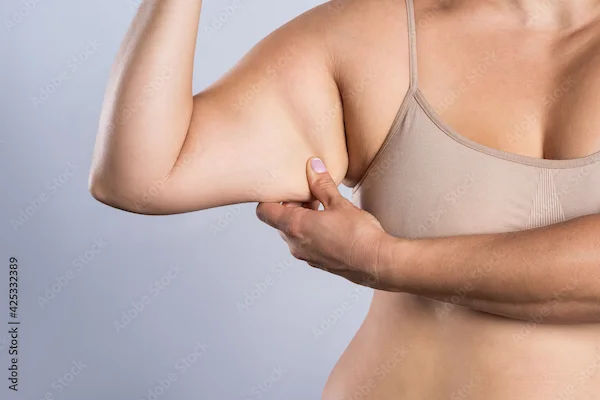 How To Reduce Biceps Fat?