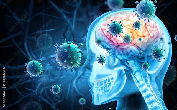 Understanding Encephalitis: What You Need to Know