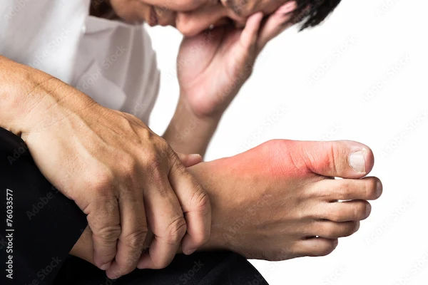 How To Reduce Uric Acid From Body?
