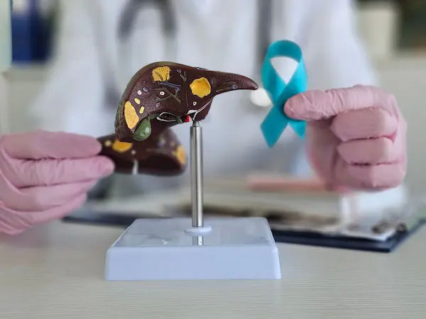 Liver Transplant Causes