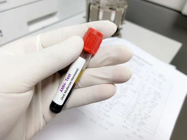 AMH Testing