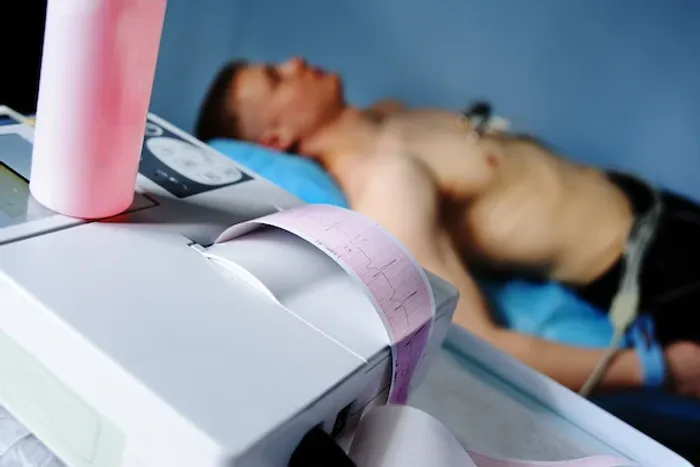 ecg test