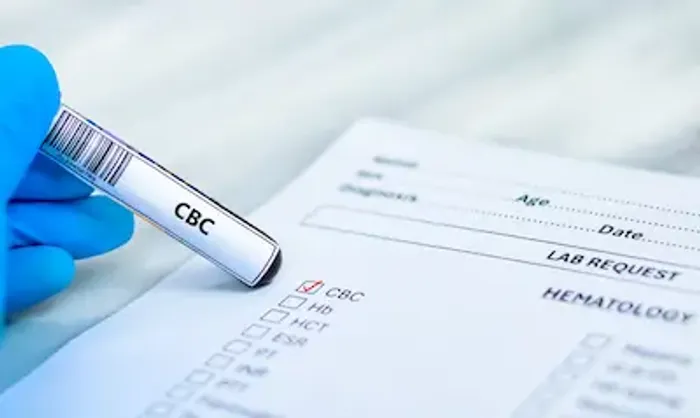 CBC Test
