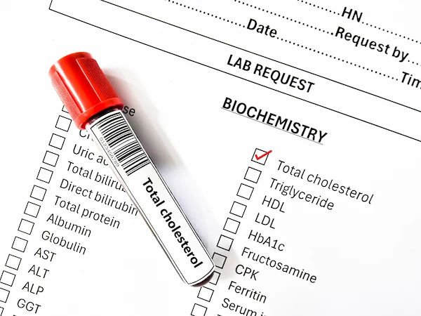 total Cholesterol (TC) test