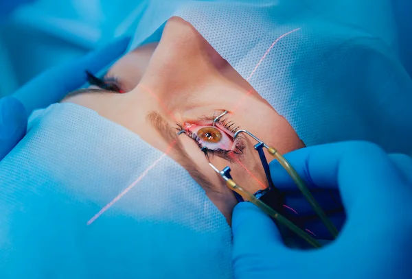 Can I Drive After LASIK Eye Surgery