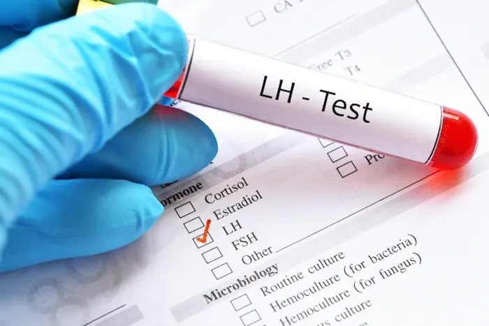 AMH or LH