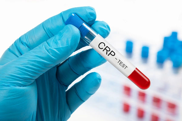 CRP Test