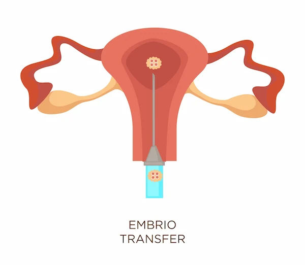 How To Increase Blood Flow To Uterus After Embryo Transfer?