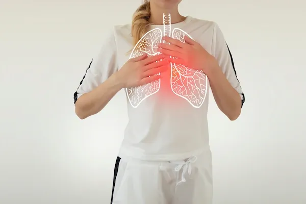 Tuberculosis