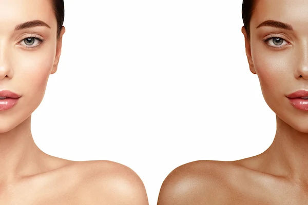 Remove Face Tan Quickly at Home