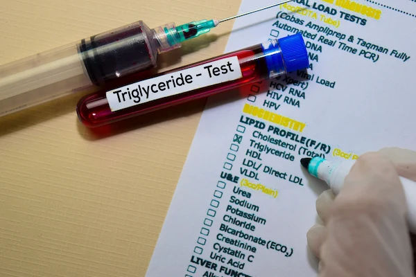 Dangerous Levels of Triglycerides Explained