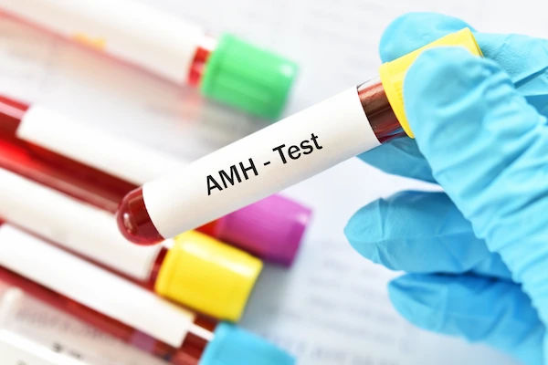 AMH Test