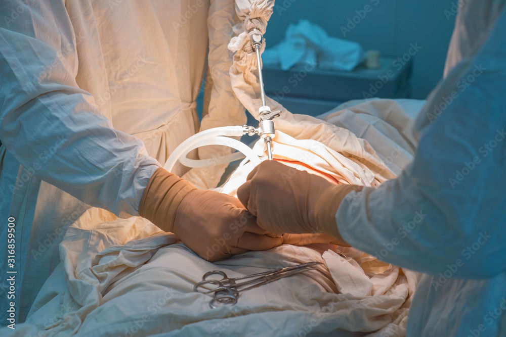 Recovery From Coronary Bypass Surgery