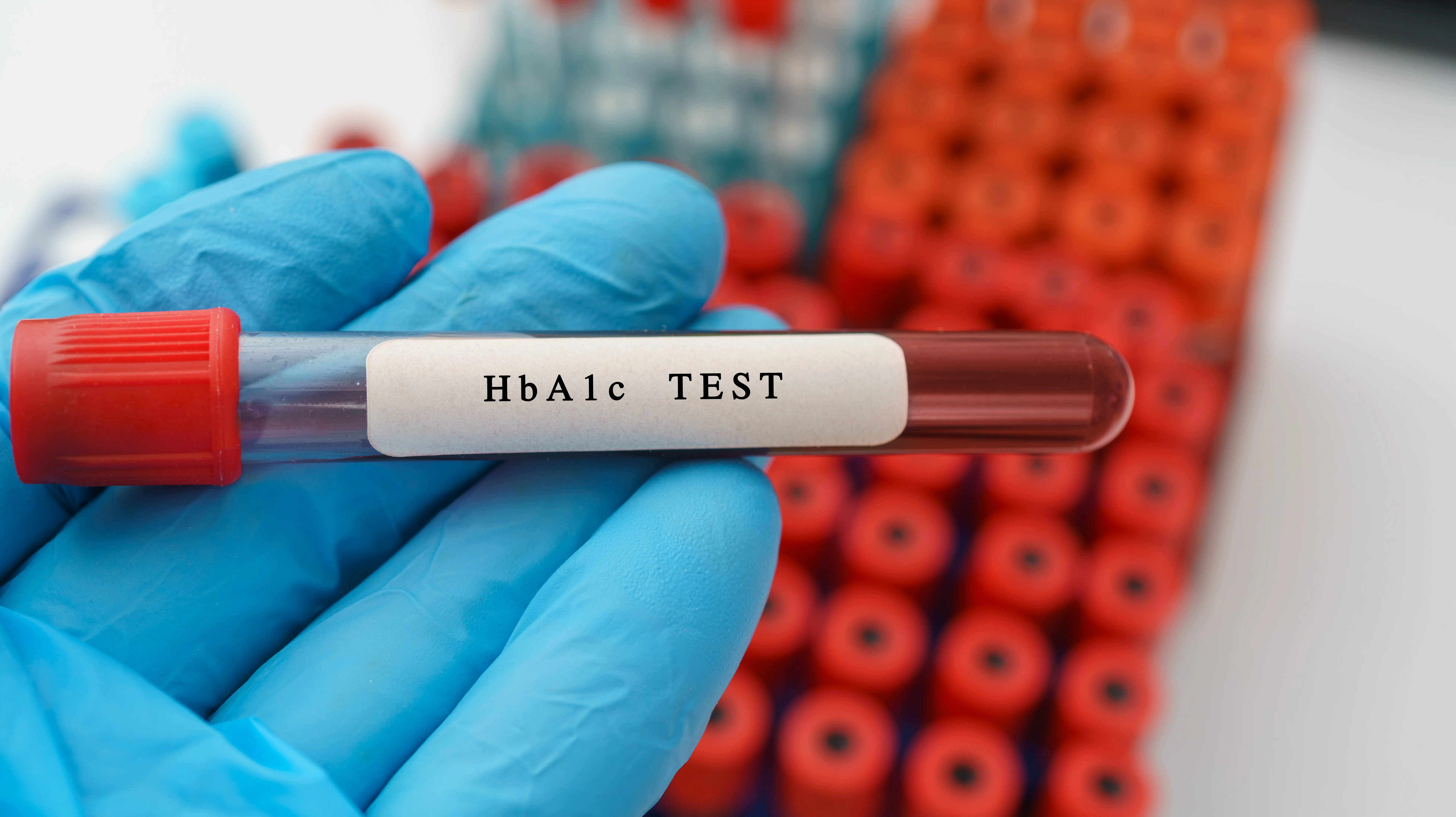 HbA1c Testing
