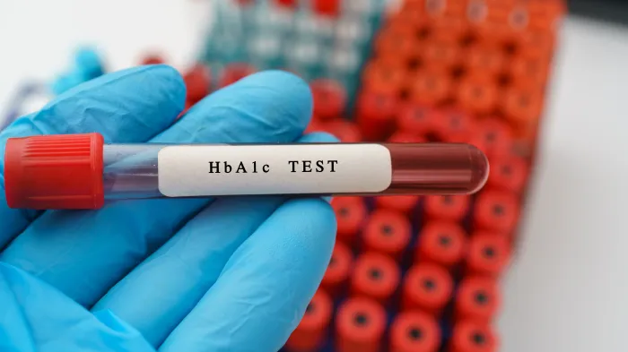 HbA1c Testing