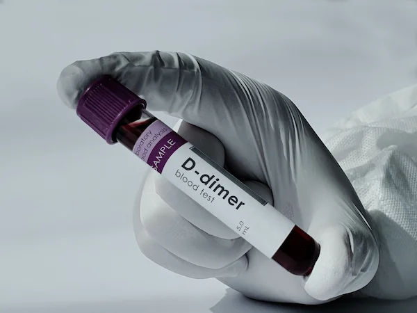 Lower High D-Dimer Levels