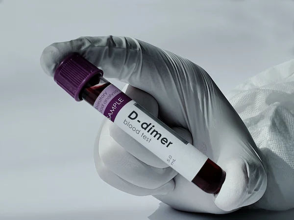 D-Dimer Test: Full Form and Overview