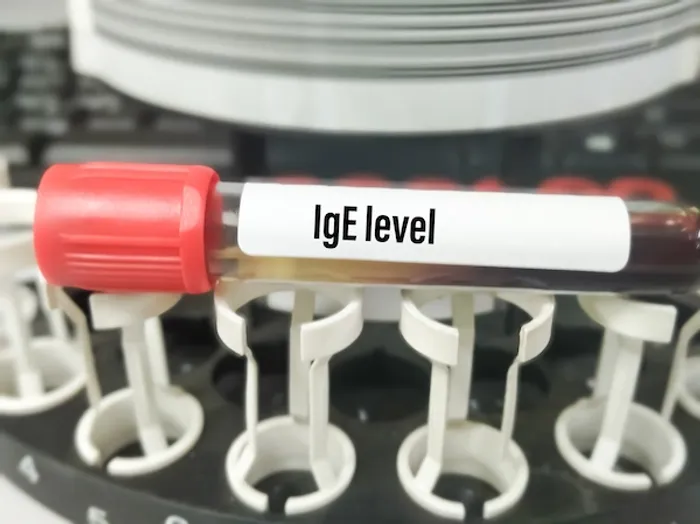 IgE Levels