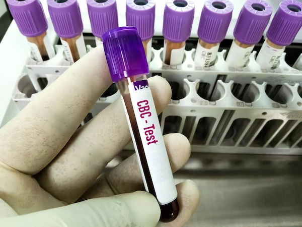 complete blood count