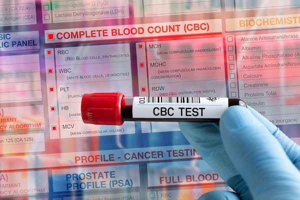 CBC Test