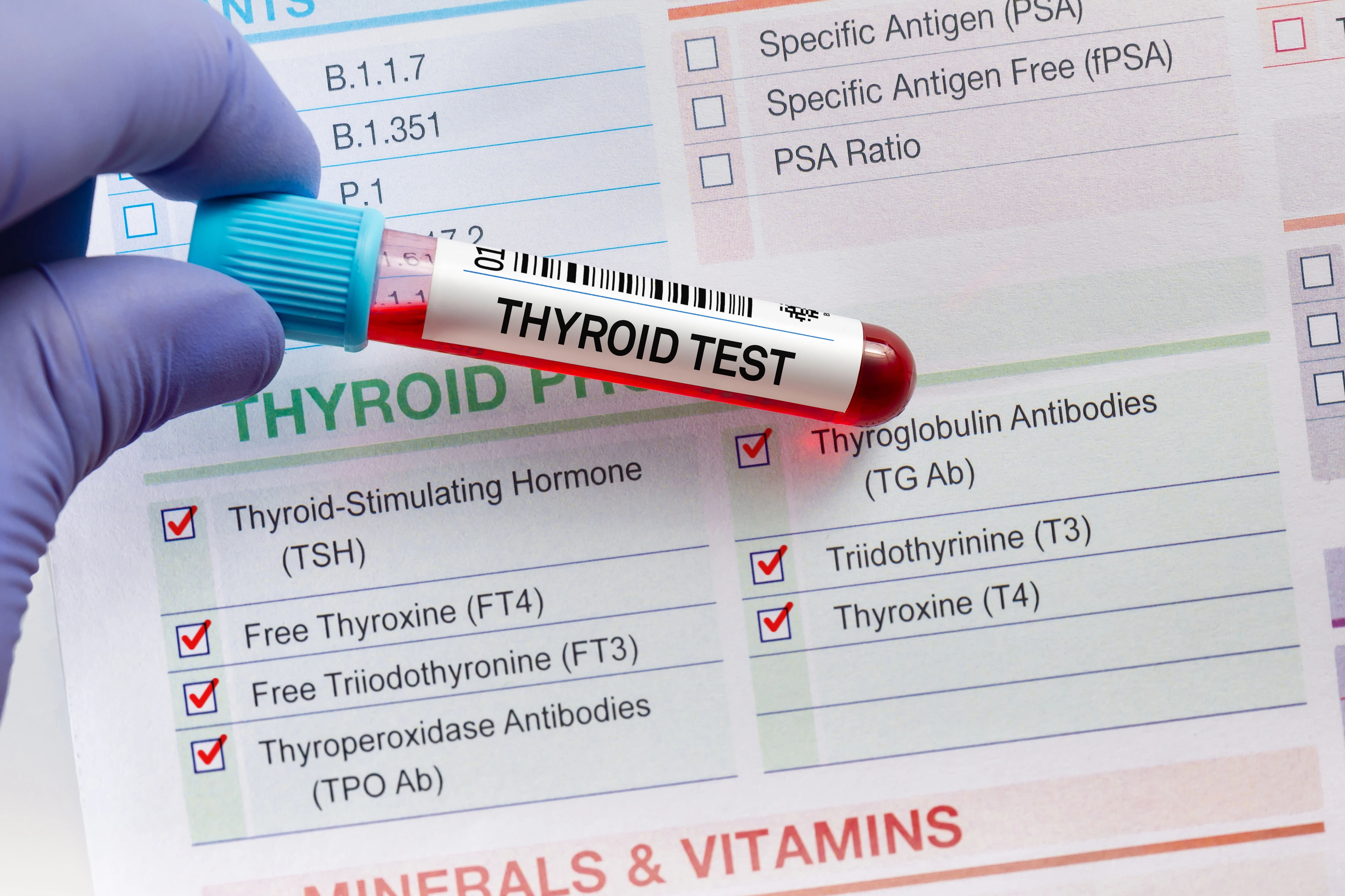 Thyroid Test