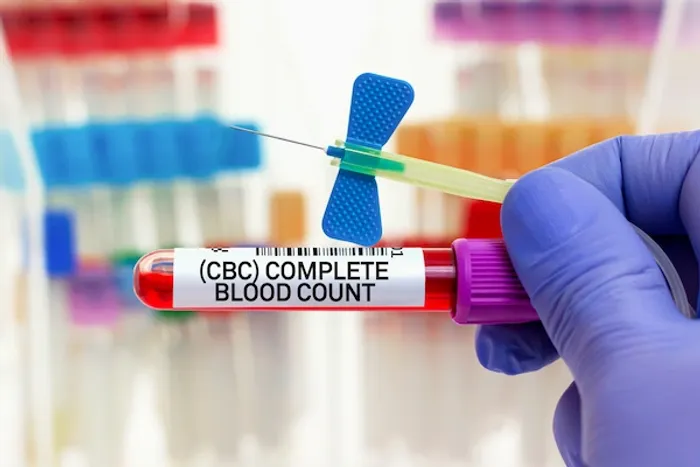 CBC Test
