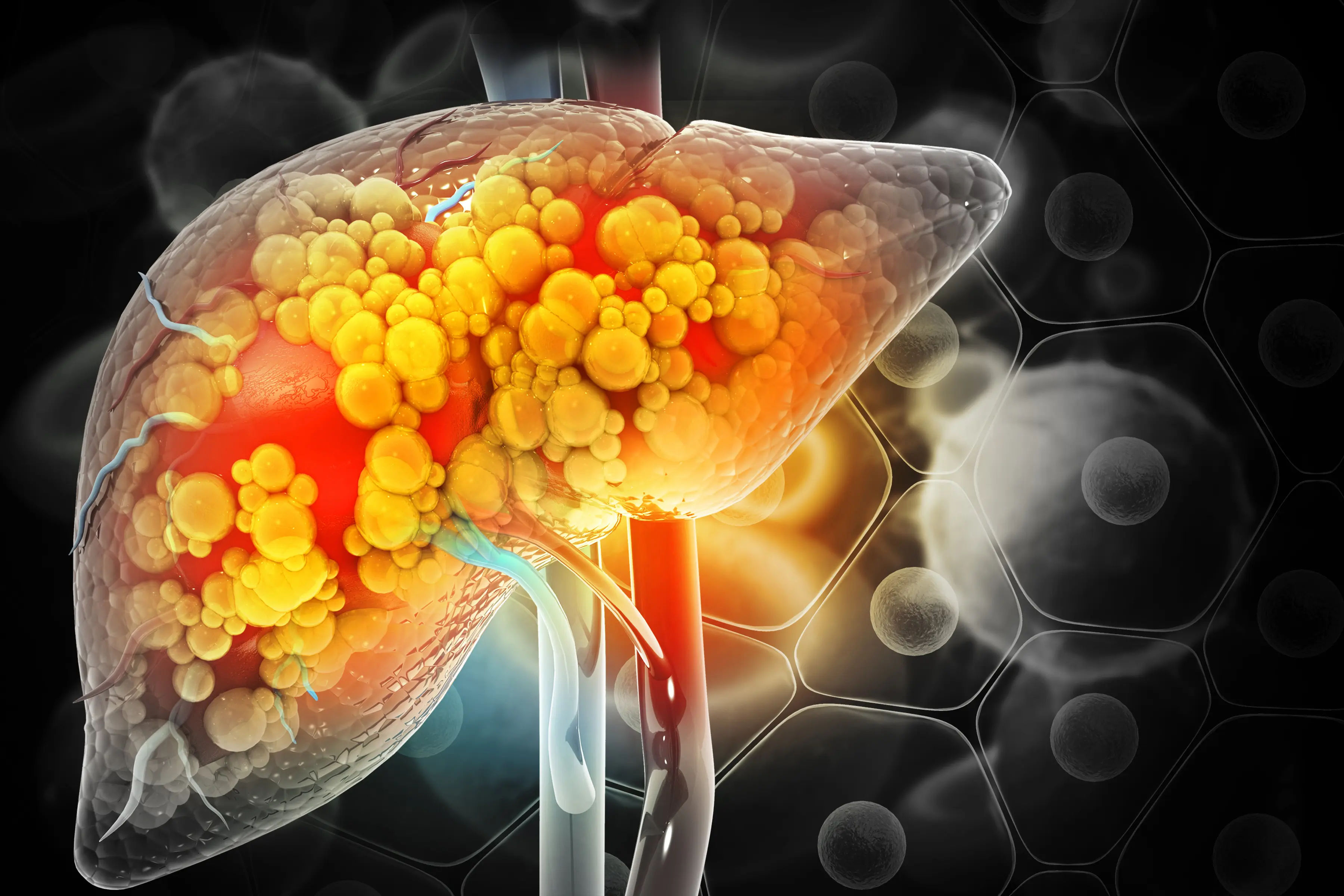 Ghee's Impact on Fatty Liver Health
