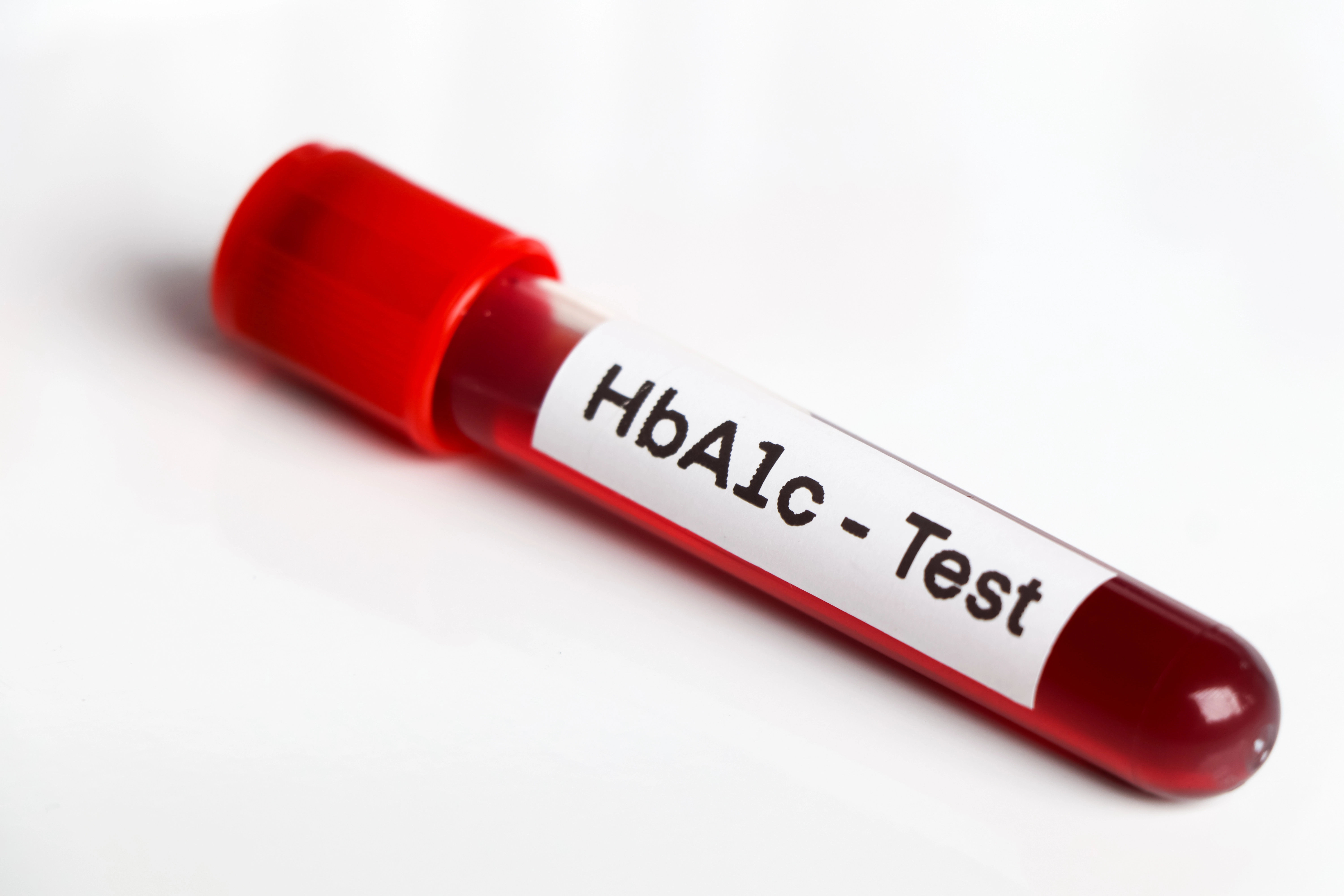 HbA1c