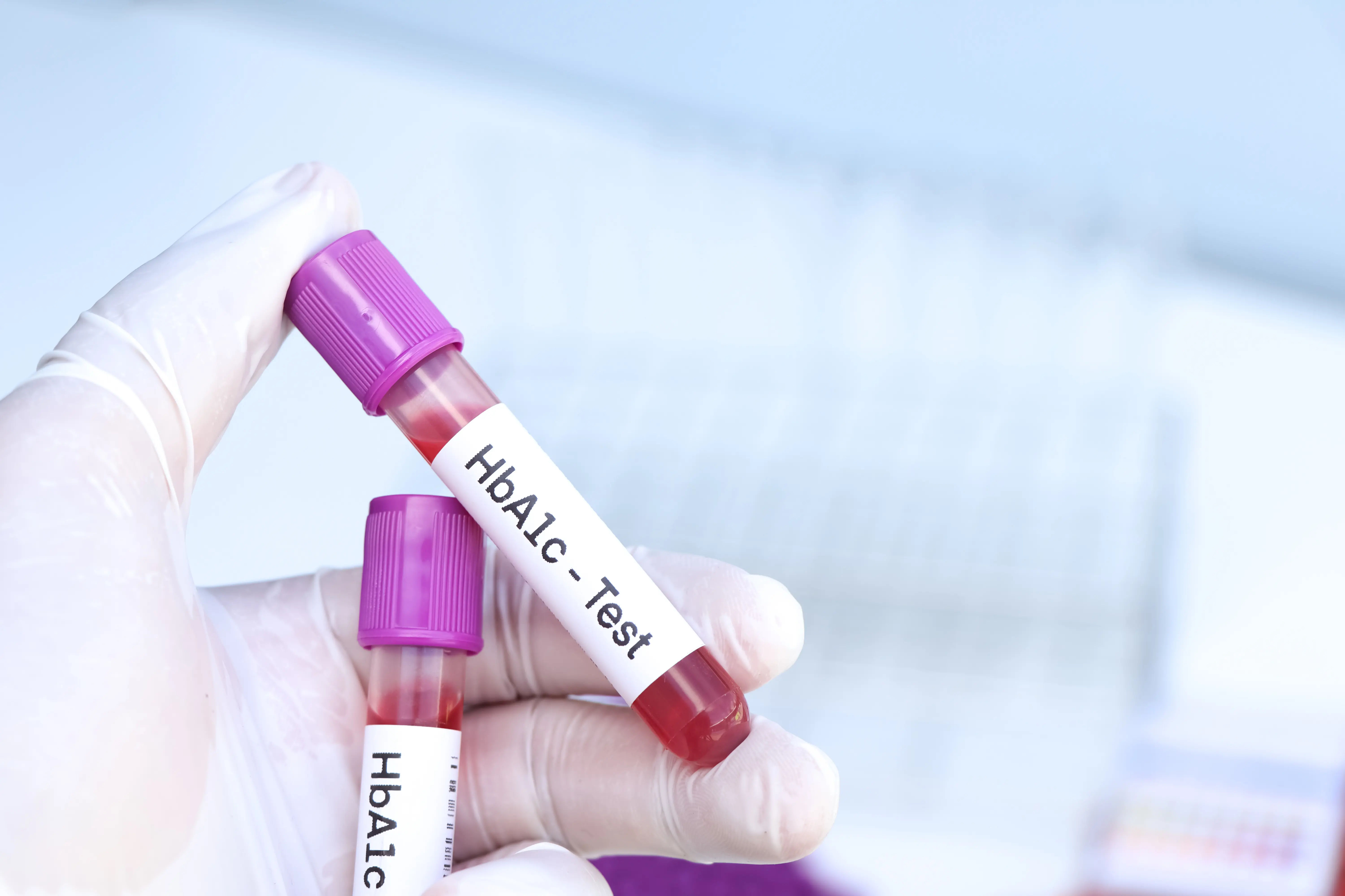 HbA1c the Best Early Test