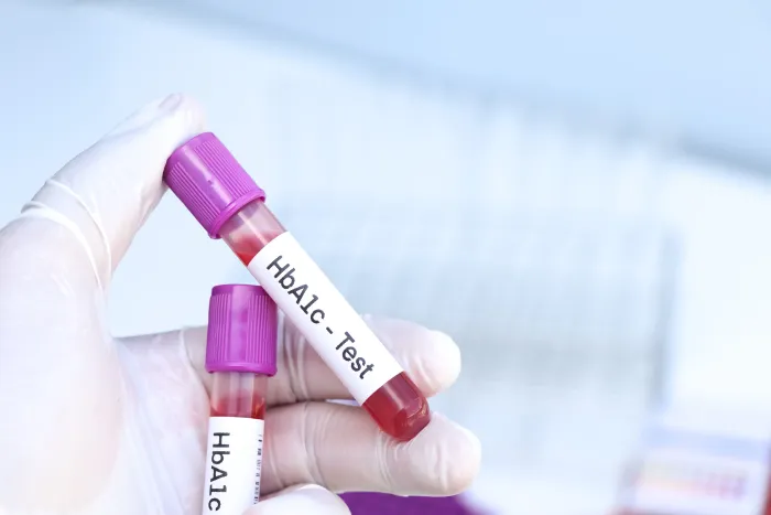 HbA1c the Best Early Test