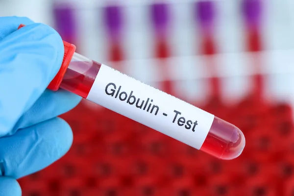 How To Increase Globulin Levels?