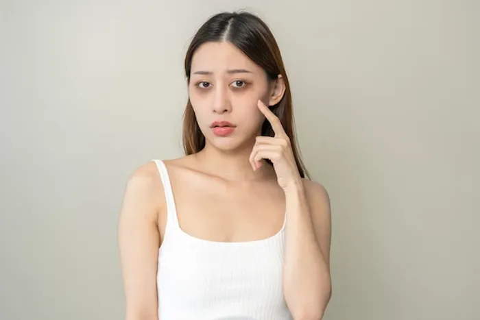 Dark Circles Relief