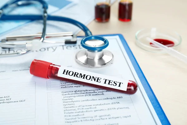 Hormone Tests