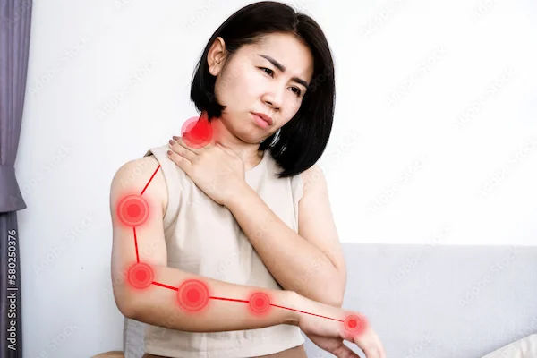 Intercostobrachial Nerve Pain After Mastectomy