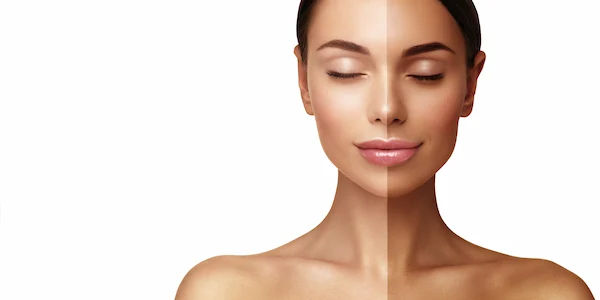 Tan Removal