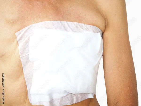 Problems After Mastectomy