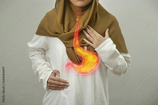 Understanding Acid Peptic Disorder