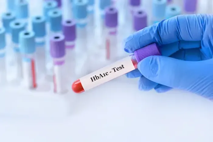 Constant Thirst, Fatigue & Weight Loss? Time to Get an HbA1c Test