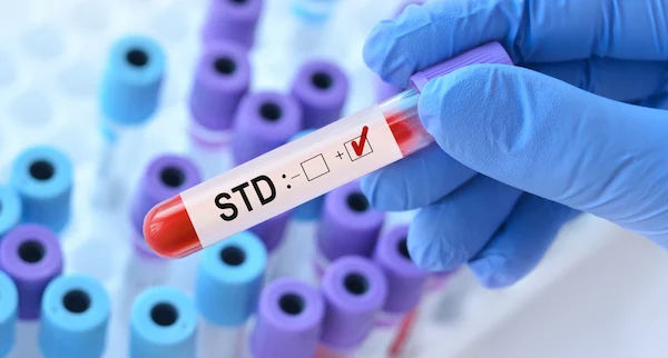 std